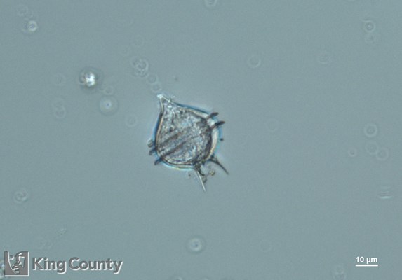 Photo of Protoperidinium pellucidum/Protoperidinium steinii